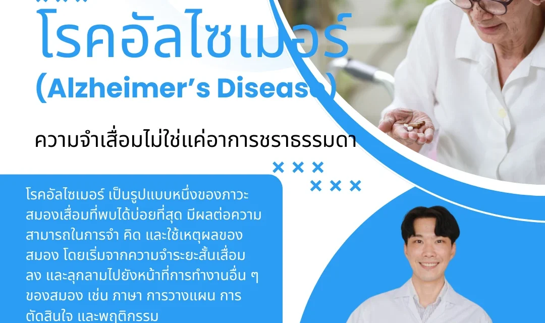 โรคอัลไซเมอร์ (Alzheimer’s Disease) รักษาอย่างไรได้บ้าง